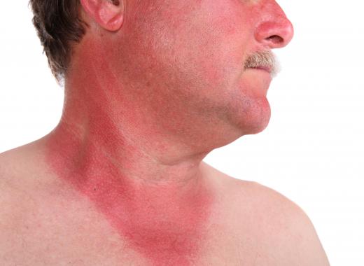 Organic sunscreen can be less toxic around the face and neck.