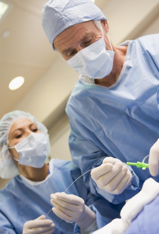 Some vascular procedures can be performed as outpatient surgery, while others require major surgery.