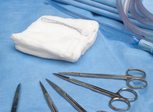 Surgical sponges are the most common material left behind during surgeries.