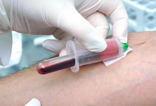 Phlebotomists must perform a venipuncture while taking precautions to avoid infection or unnecessary pain.