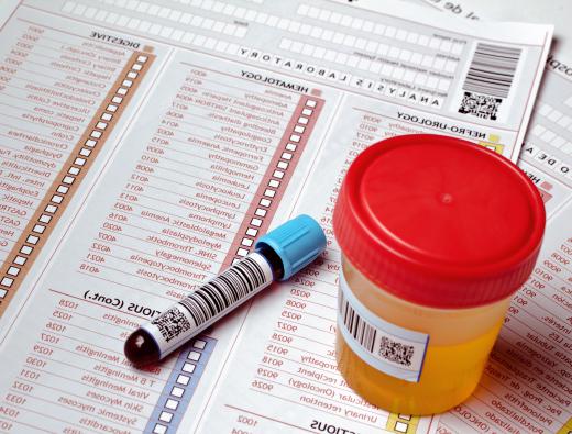 Lab technicians often evaluate blood and urine samples.