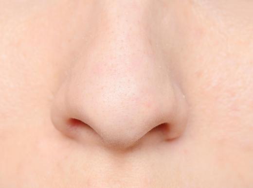 A pore refining cleanser is used to minimize pores.