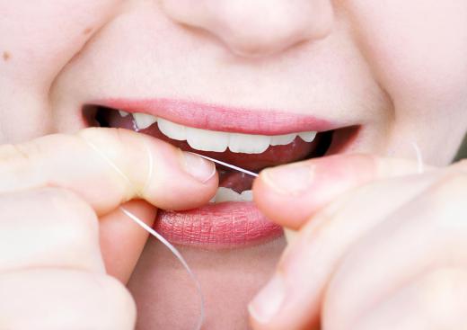 Daily flossing keeps sugar from settling in gum pockets.