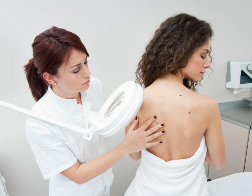 Doctors can perform a skin exam for patients in order to detect any cancer.