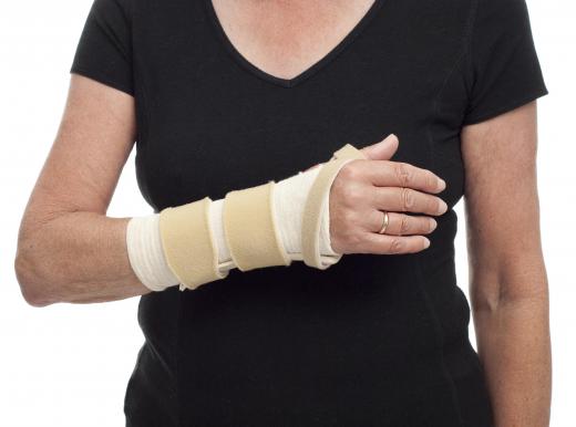 Doctors may recommend hand splints as a way to help relieve the symptoms caused by repeated hand flexion.