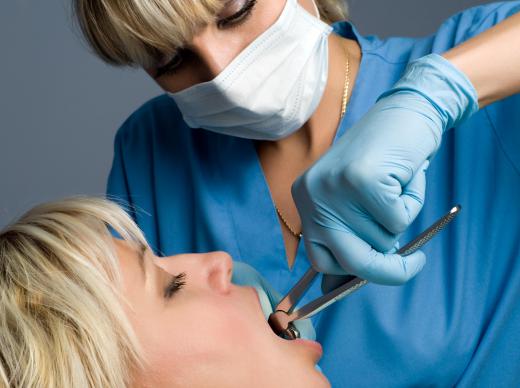 One common type of orthodontic treatment is tooth extraction.