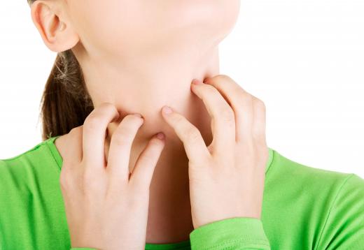 For some people, the anesthesia used for a neck lift surgery can cause itching and other allergy-like reactions.