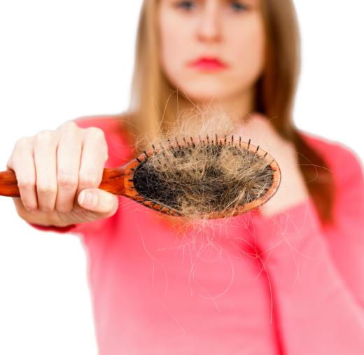 Hair loss in bulemics is caused by malnutrition.