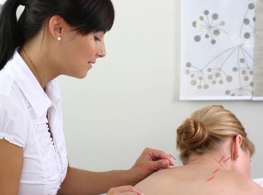 Rather than using needles, electro acupuncture uses an electrical current to stimulate the nerves.