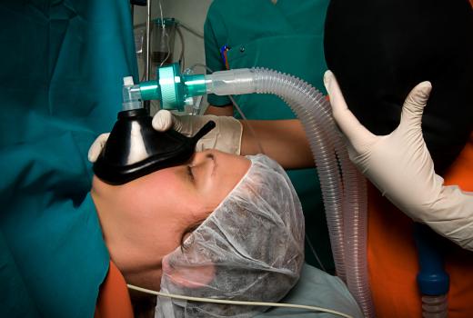 CO2 laser resurfacing requires general anesthesia.