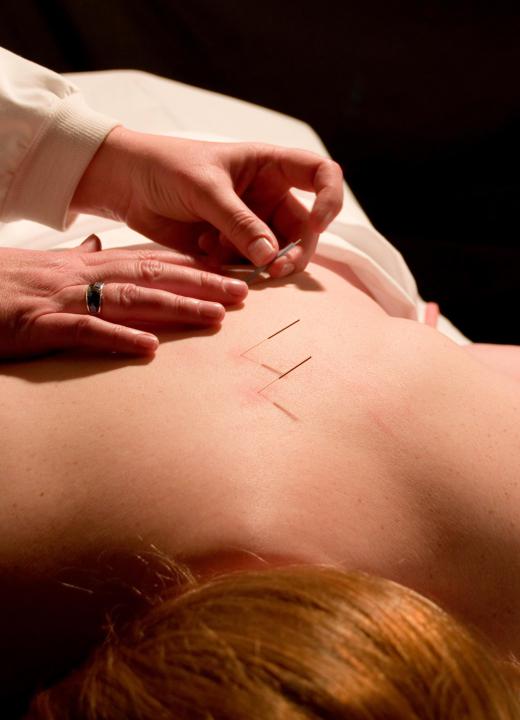 Studies have shown that acupuncture can reduce blood pressure by a small amount.