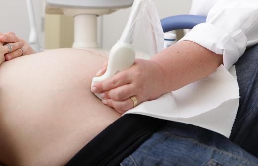 An ultrasound may be required to help determine if an ectopic pregnancy is present.