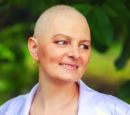 Chemotherapy drugs are highly toxic, and may cause hair loss in some patients.