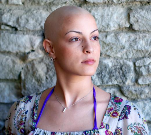 Navelbine, like other chemotherapy treatments, may cause temporary hair loss.