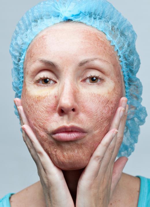 Rough, dry skin may stem from environmental factors.