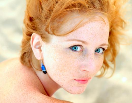 Although skin cancer can affect anyone, people with a fair complexion and light-colored eyes are the most susceptible.