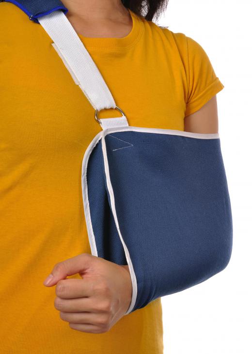 Tendinitis in the shoulder or arm can be treated with a shoulder sling.