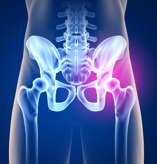 The hip bone is commonly the source of a bone graft.