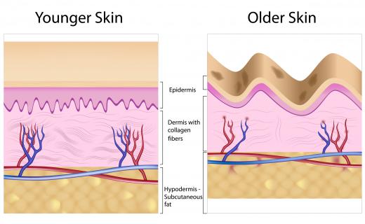 A diagram of younger and older skin showing the decrease in collagen in older skin. Anti-aging products are often designed to boost the production of collagen, helping to make the skin smoother.