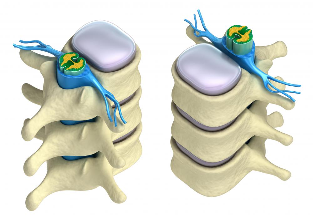 What is the Anatomy of the Spine? (with pictures)