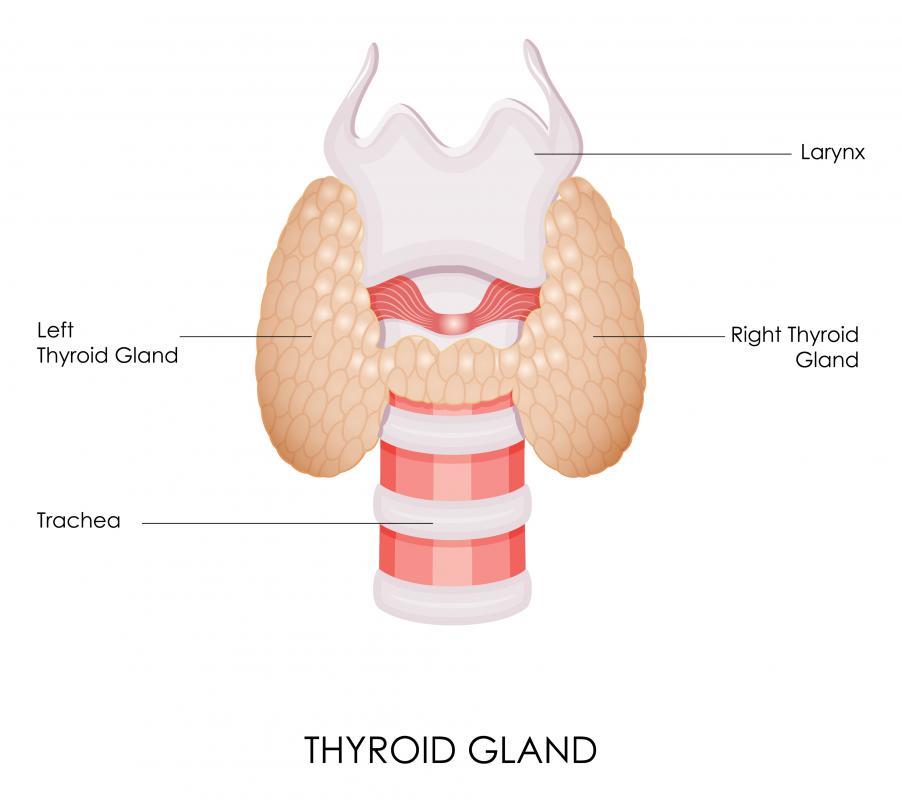 hyperactive bowel sounds symptom of hyperthyroidism