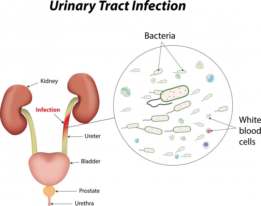 what uti bacteria does doxycycline treat