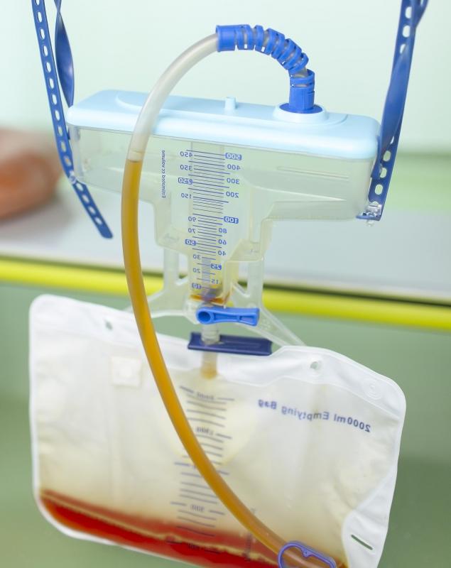 What is a Catheter Bag? (with pictures)