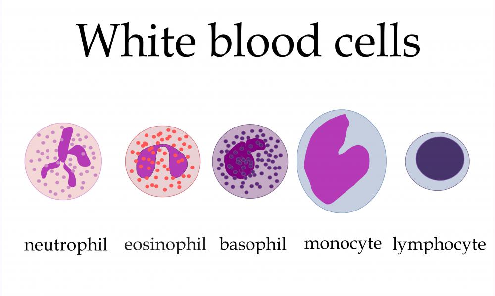 What are Granulocytes? (with pictures)