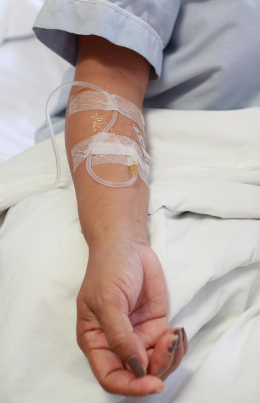 What are Intravenous Fluids? (with pictures)