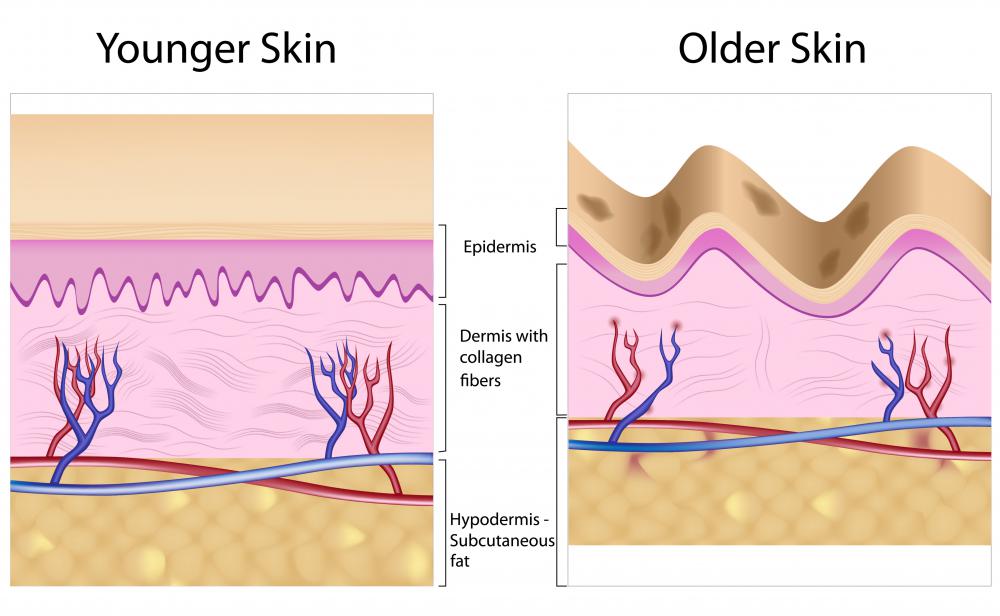 what-is-the-dermis-with-pictures